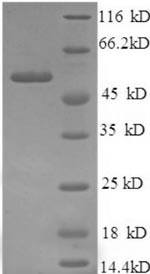Islet cell autoantigen 1 (ICA1), partial, human, recombinant
