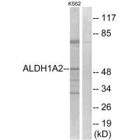 Anti-ALDH1A2