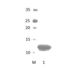 LMO7 PDZ Domain
