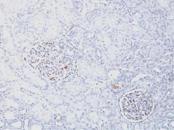 Anti-Wilm&#039;s Tumor 1 (WT1) (Wilm&#039;s Tumor &amp; Mesothelial Marker) (clone: WT1/1434R) (recombinant rabbit
