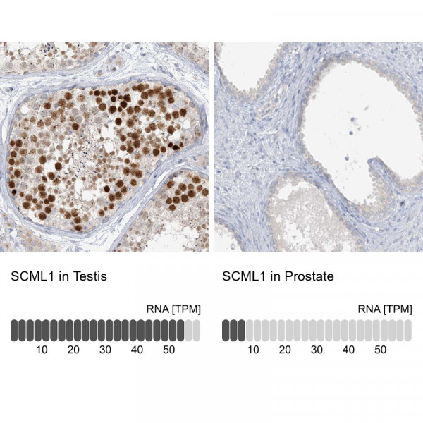 Anti-SCML1