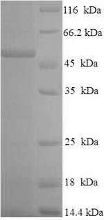 Granulocyte-macrophage colony-stimulating factor receptor subunit alpha (CSF2RA), partial, human, re
