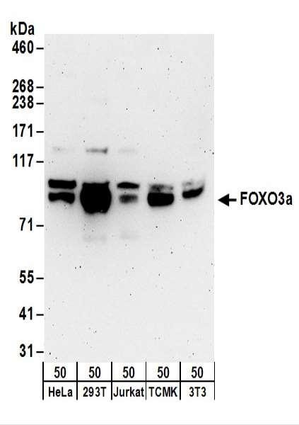 Anti-FOXO3a