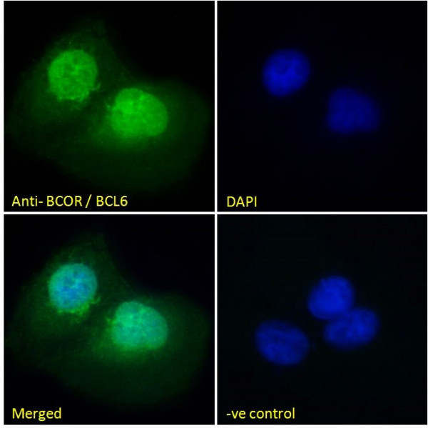 Anti-BCOR / BCL6 co-repressor, N-terminal