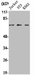 Anti-SENP1