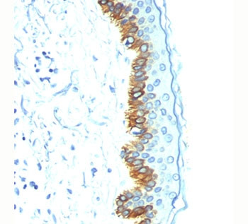 Anti-acidic Cytokeratin, clone AE1