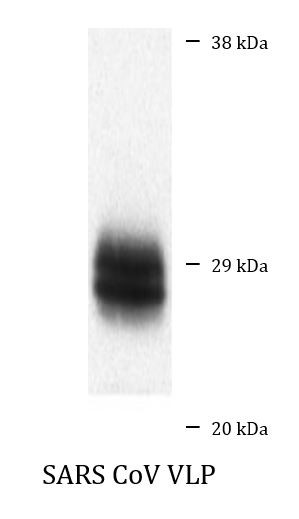 Anti-SARS-CoV M protein