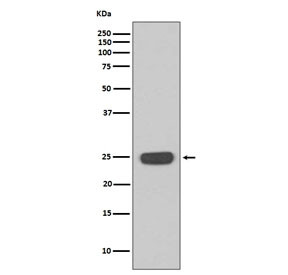 Anti-Interferon gamma / IFNG, clone AOFD-9