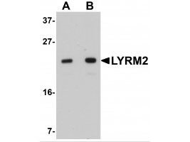 Anti-LYRM2