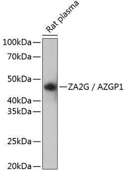 Anti-Zinc-alpha2-glycoprotein (ZAG/AZGP1)