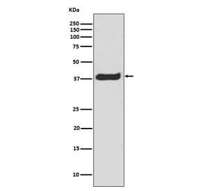 Anti-LAT / Linker for Activation of T cells (pY191), clone AOH-12