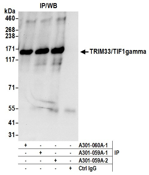 Anti-TRIM33/TIF1gamma