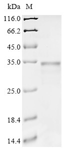Phenylalanine-4-hydroxylase (phhA), Chromobacterium violaceum, recombinant