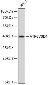 Anti-ATP6V0D1
