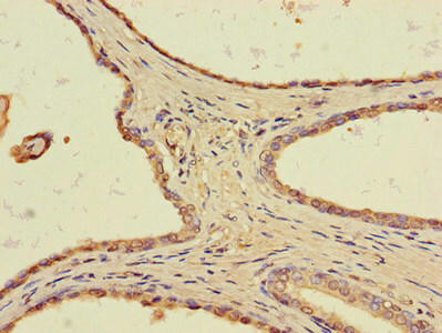 Anti-TLL1