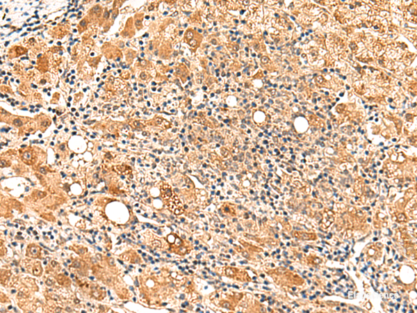 Anti-PAFAH1B2