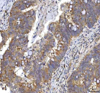 Anti-RASGRP3 / Ras guanyl-releasing protein 3