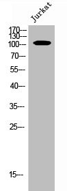 Anti-Phospho-EPHA4 (Y596)
