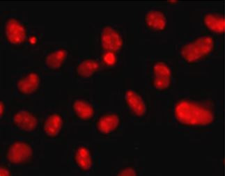 Anti-HMG20A