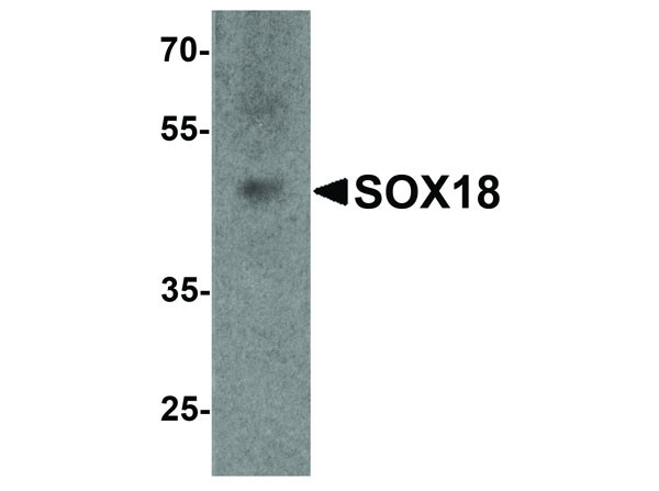 Anti-SOX18