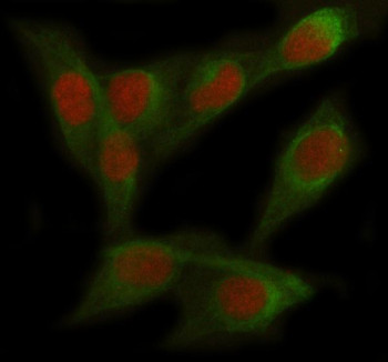 Anti-FOXC2 / Forkhead box protein C2