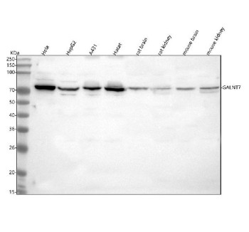 Anti-GALNT7 / Polypeptide N-acetylgalactosaminyltransferase 7