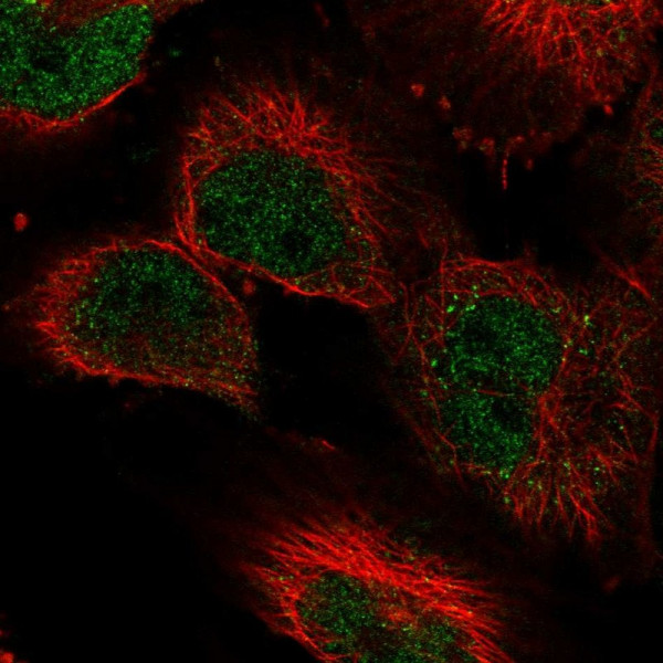 Anti-KDM3A
