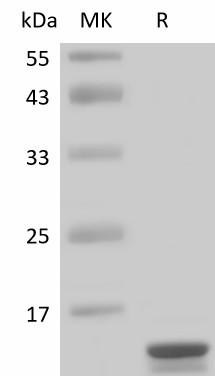 Interleukin-2/IL-2 (human), recombinant protein (active)