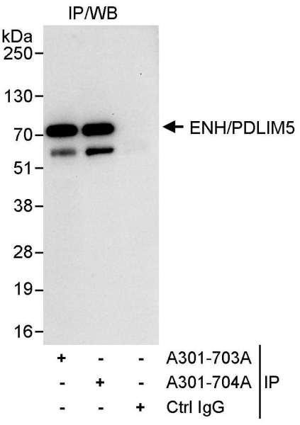 Anti-ENH/PDLIM5