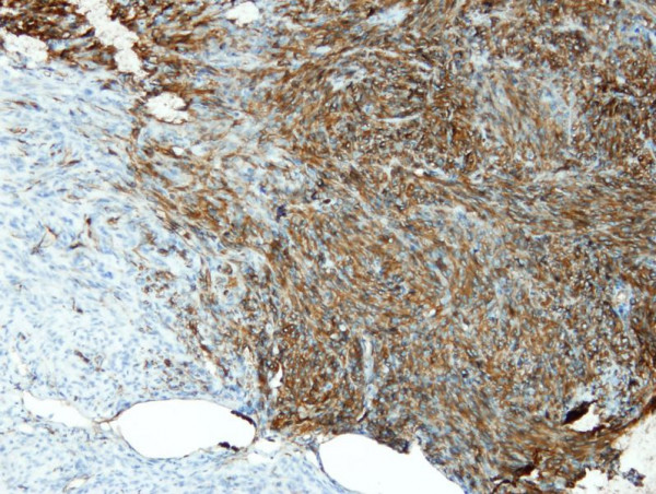 Anti-CD34, clone Q19-E