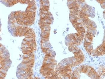 Anti-EpCAM / Extracellular domain, clone EGP40/1384