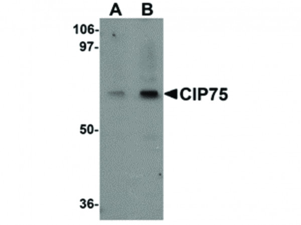 Anti-CIP75