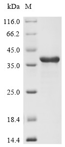 Non-receptor tyrosine-protein kinase TYK2 (TYK2), partial, human, recombinant