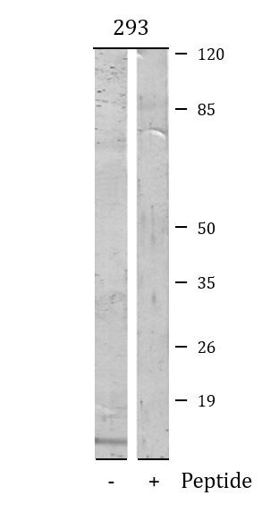 Anti-Caspase 5 (cleaved p10)