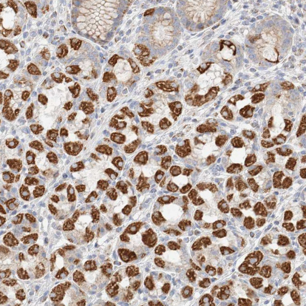 Anti-ATP6V1C1