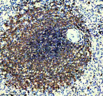 Anti-CD22 / BL-CAM, clone CBO-3