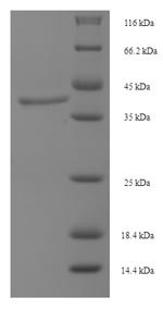Lutropin-choriogonadotropic hormone receptor (LHCGR), partial, human, recombinant