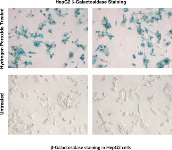 Senescence-Associated beta-Galactosidase Staining Kit