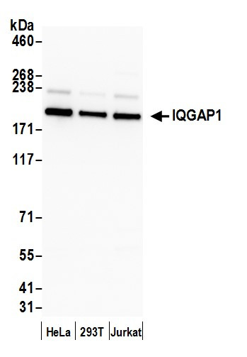 Anti-IQGAP1