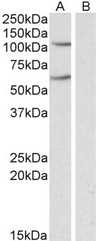 Anti-IREB2 / IRP2, Internal