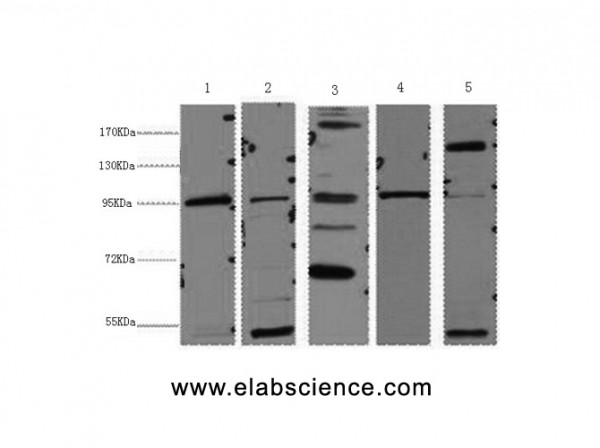 Anti-Catenin beta, clone 1F5