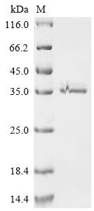 Retinaldehyde-binding protein 1 (RLBP1), recombinant human