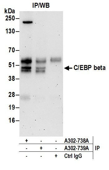 Anti-C/EBP beta