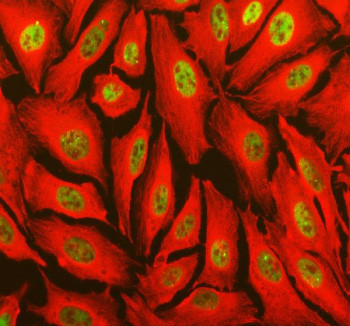 Anti-TOPBP1 / DNA topoisomerase II-binding protein 1