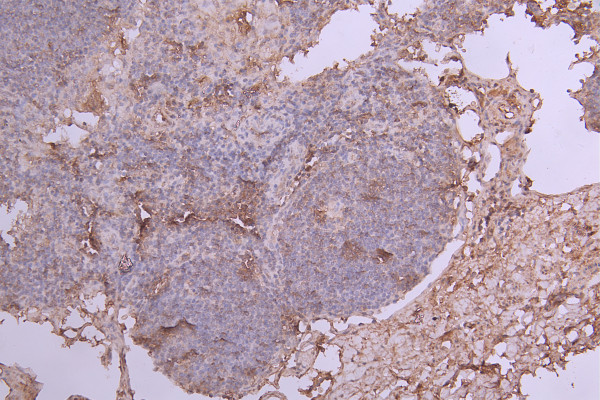 Anti-IL6, recombinant clone 7F5