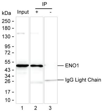 Anti-ENO1