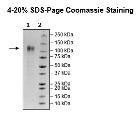 Spike S1 (B.1.1.529 BA.1, Omicron Variant), Avi-His-Tag, Biotin-Labeled (SARS-CoV-2)