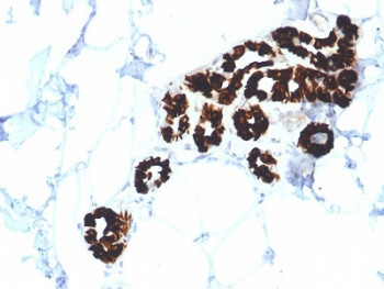 Anti-KRT15 / Cytokeratin 15, clone KRT15/2554
