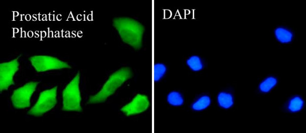 Anti-ACPP, clone SQab1871