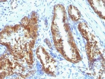 Anti-PSA Cocktail (Prostate Specific Antigen), clone A67-B/E3 + 1A7